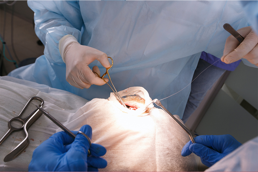 口腔内の外科手術