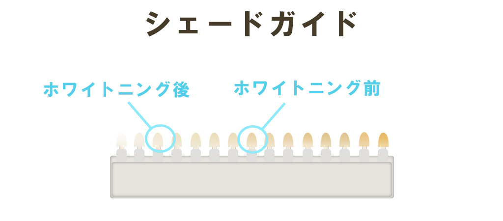 シェードガイド・大宮いしはた歯科