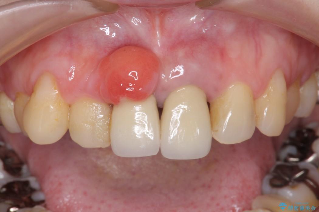 病理検査を行う理由・大宮いしはた歯科