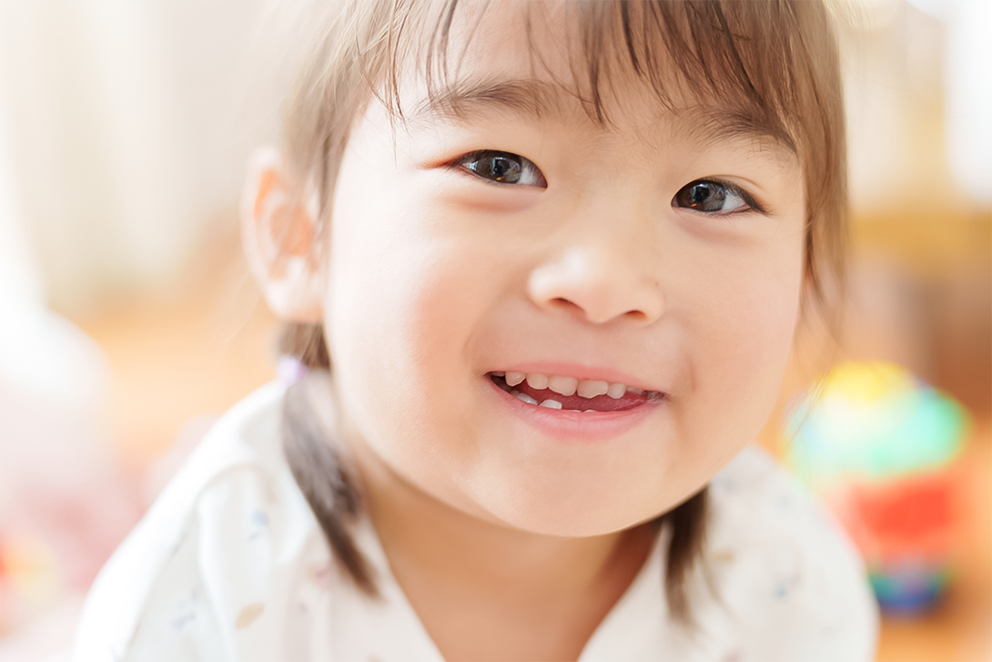 子どもの受け口は何歳から治療した方がいい？