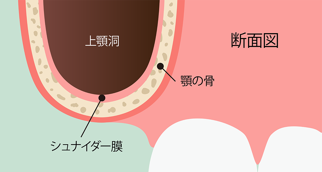 サイナスリフト術 手順1:顎の骨の名称