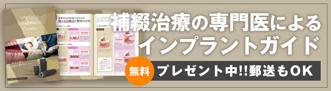 インプラント補綴治療の専門医によるインプラントガイド|大宮いしはた歯科