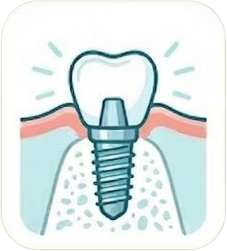 石幡先生の得意な治療：インプラント