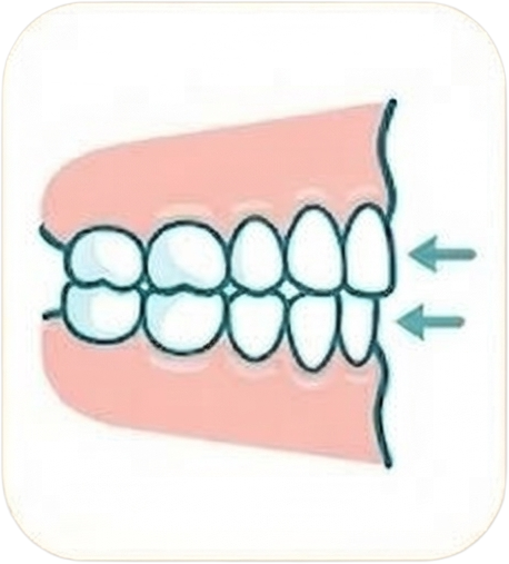 石幡先生の得意な治療：嚙み合わせ